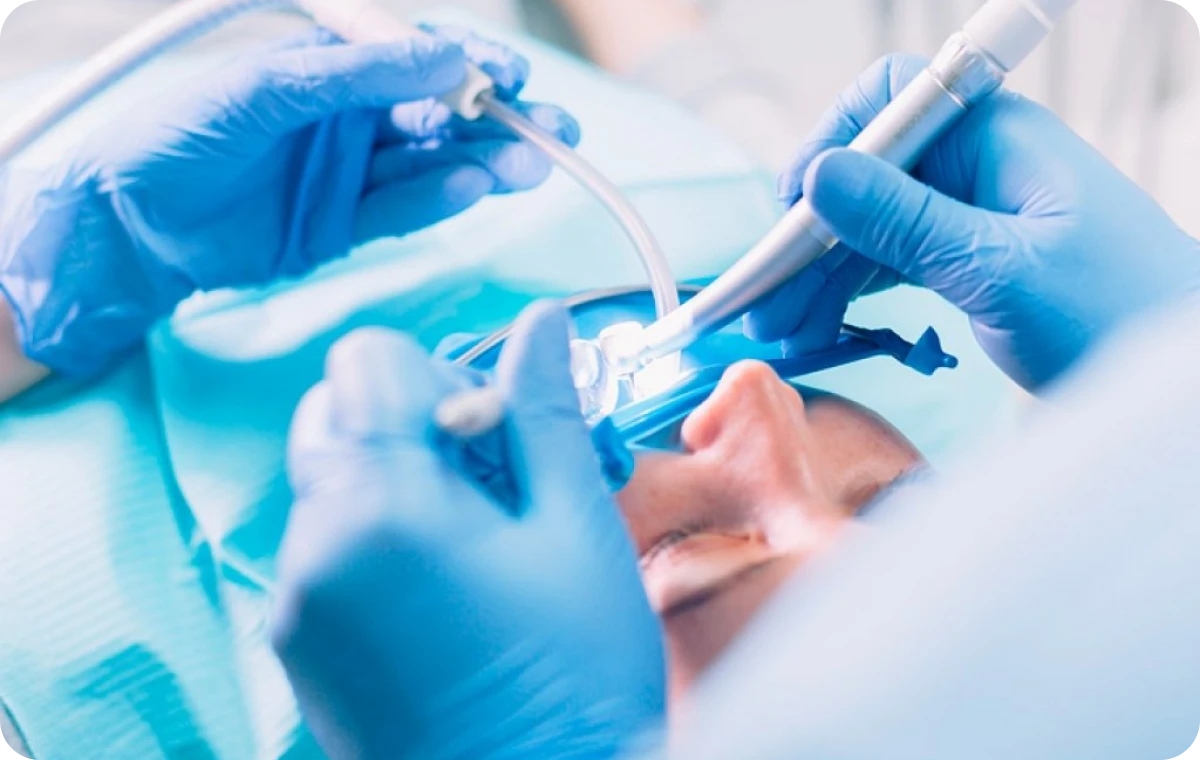 chirurgie dentaire mesnils sur iton Chirurgie dentaire