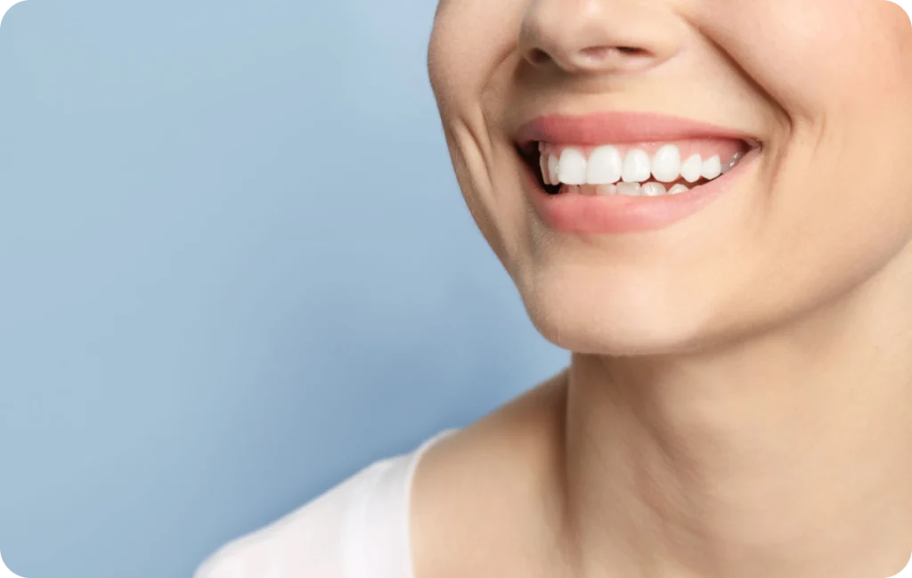 dentiste drs simon gervais Traitement par érosion-infiltration